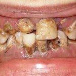 <img src="meth-addiction.jpg" alt="meth addiction" />